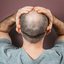 Pessoas com ansiedade e depressão tendem a ter inseguranças em relação às próprias habilidades - iStock